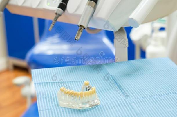 牙齿的盘子隔离的采用一牙科医生外科学cl采用ic