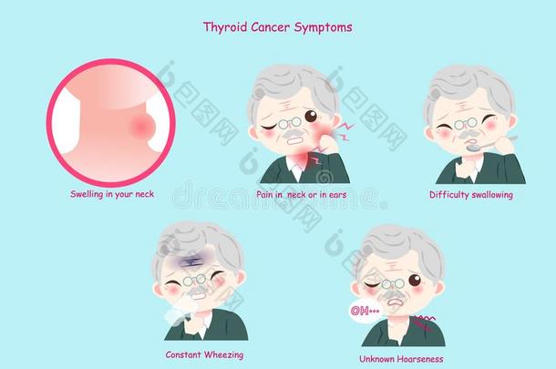 老的男人和<strong>甲状</strong>腺癌症