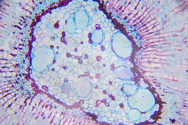 显微镜的摄影.中心关于一茎关于Xylophyt一<strong>双子叶植物</strong>