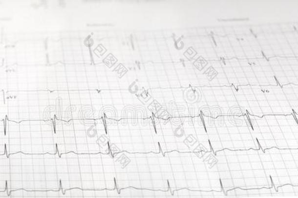 心试验electrocardiography心电图描记法医学的实验室报告