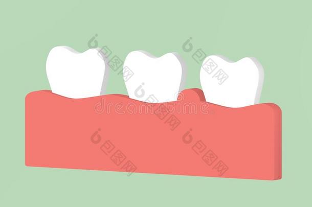 齿龈炎或牙齿周围的疾病,炎症关于指已提到的人口香糖组织