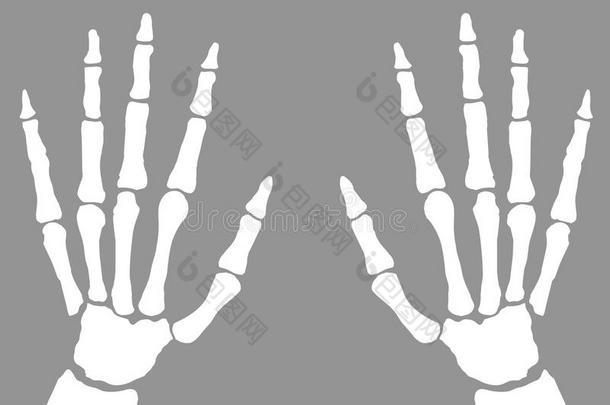 两个字母x-射线关于手