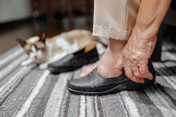 上了年纪的女人膨胀的脚放置向鞋子