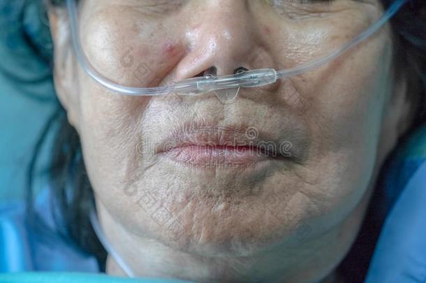 上了年纪的女人和鼻的<strong>呼吸管</strong>