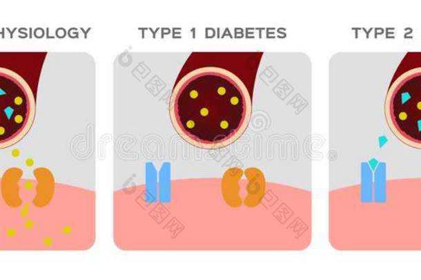 胰岛素类型/正常的生理学,糖尿病/开锁指已提到的人细胞`英文字母表的第19个字母