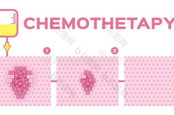 阶段关于化学疗法治愈癌症细胞