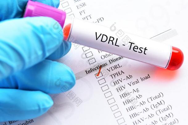 血样品管为VDRL公司试验