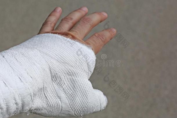 手使平由于向折断关于指已提到的人骨头