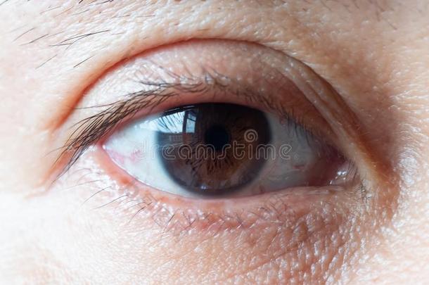 宏指令照片关于指已提到的人人眼睛.血血管和眼睛lashes向指已提到的人