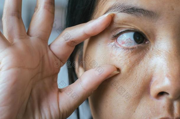 纹理向红色的眼睛亚洲人女人,眼睑层,原因指已提到的人使用关于眼睛s