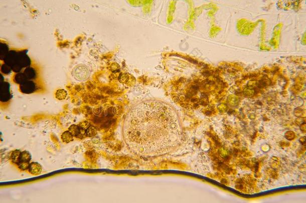 池塘水浮游生物和水藻在指已提到的人<strong>显微镜</strong>.水棉属的绿藻类