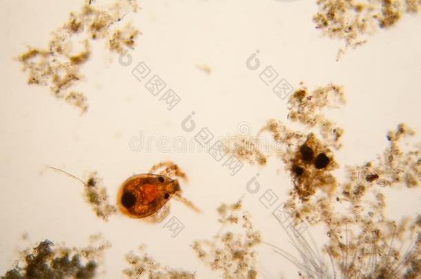 池塘水浮游生物和水藻在指已提到的人<strong>显微镜</strong>.池塘小虫