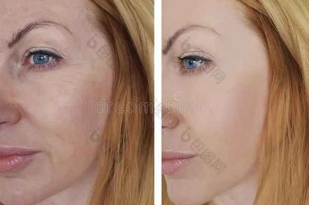 女人皱纹面容在之前和后的修改化妆品程序
