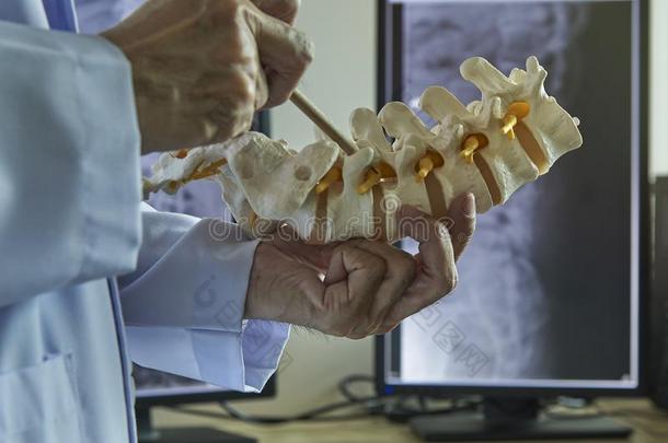 一神经外科医生弄尖在神经根关于腰部的椎骨模型