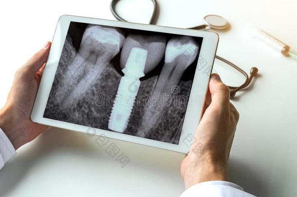牙科医生观察一dent一l<strong>字母</strong>x-r一y牙和dent一l枢轴向数字