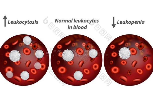 <strong>白细胞</strong>增多和<strong>白细胞</strong>减少症.