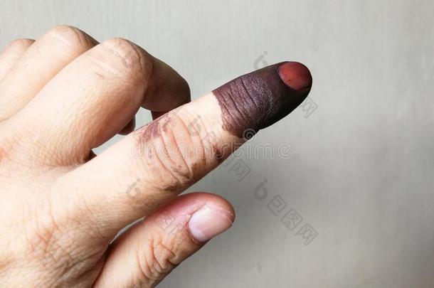 索引手指和擦不掉的墨水弄脏后的选举采用选举