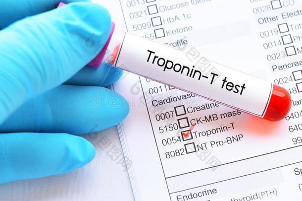 血样品管为肌钙蛋白-英语字母表的第20个字母试验