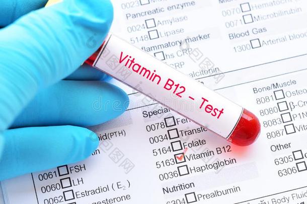 血样品管为维生素英语字母表的第2个字母12试验