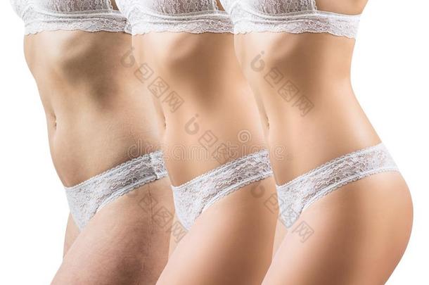 女人在之前和后的重量损失.身体减<strong>食疗</strong>法观念.