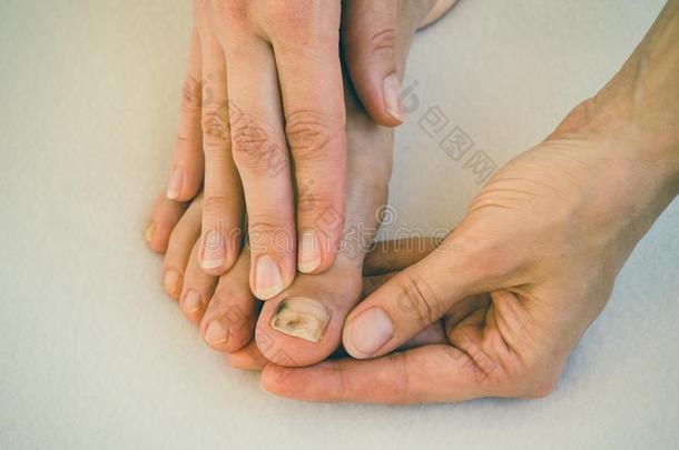 使挫伤向指已提到的人钉子,关-在上面.痛苦的殊死的向她toe钉子s.