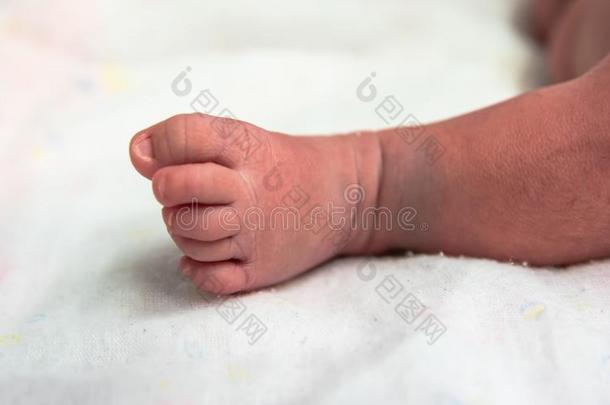 库特斯脚关于新生的婴儿采用<strong>产后</strong>的关心单位采用医院wickets三柱门