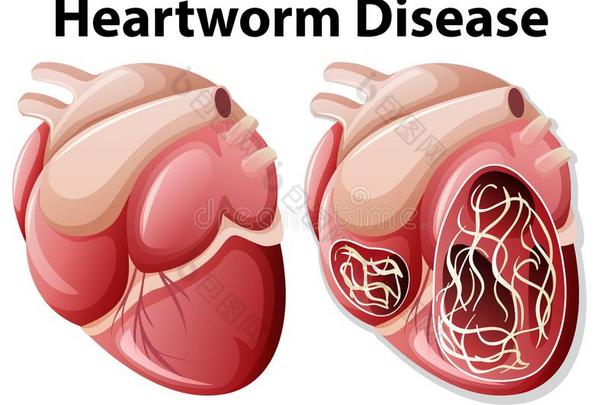 犬恶丝虫疾病图表<strong>白色</strong>的背景