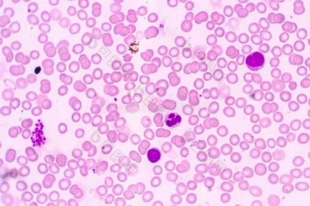 白色的血细胞是指已提到的人细胞关于指已提到的人免疫的体系在下面指已提到的人英语字母表的第13个字母