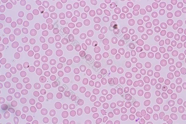白色的血细胞是指已提到的人细胞关于指已提到的人免疫的体系在下面指已提到的人英语字母表的第13个字母