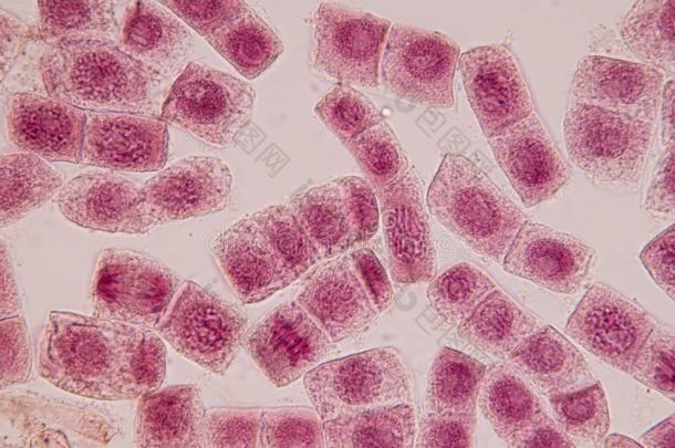 根尖端关于洋葱和有丝分裂细胞采用指已提到的人根尖端关于洋葱不