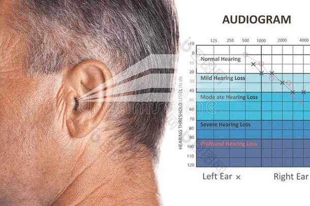 成熟的男人和症状关于听力损失