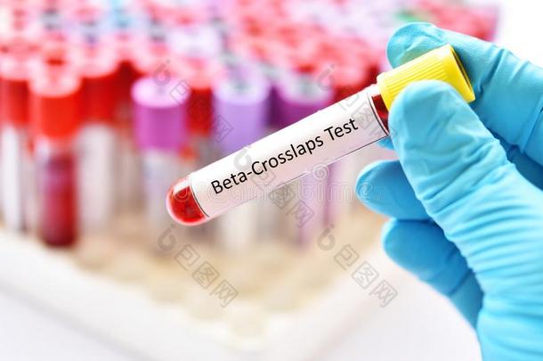 血样品为贝塔-Ⅰ型胶原降解产物或贝塔-心脏移植试验