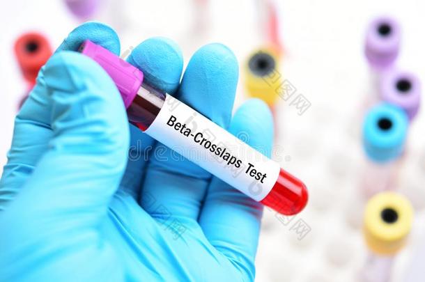 血样品为贝塔-Ⅰ型胶原降解产物或贝塔-心脏移植试验