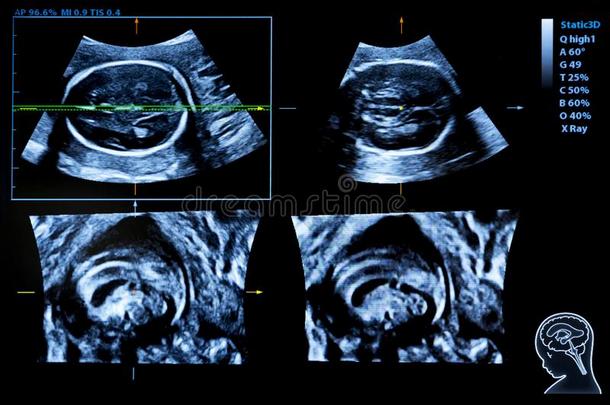 颜色鲜艳的影像关于怀孕超声显示屏