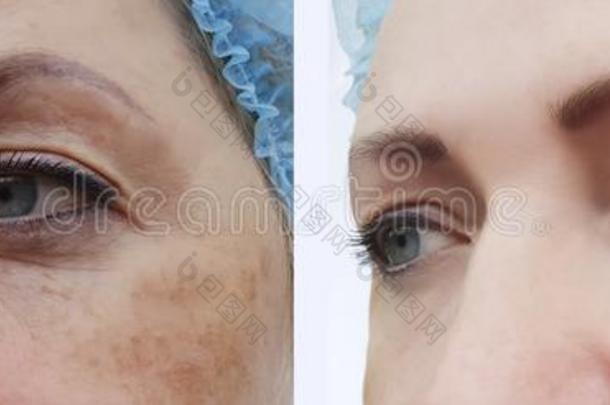 面容女人皱纹年龄皮肤病染色修改举起
