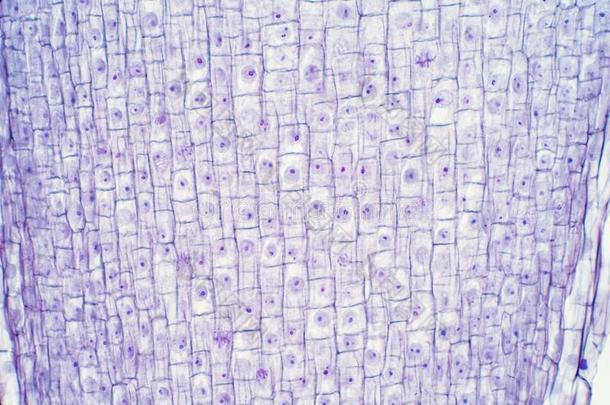 根尖端关于洋葱和有丝分裂细胞采用指已提到的人根尖端