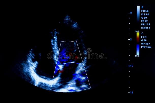 颜色鲜艳的影像关于霍曼心超声显示屏