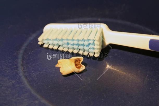 坏的牙和块关于巧克力腐烂的牙和巧克力-包图企业站