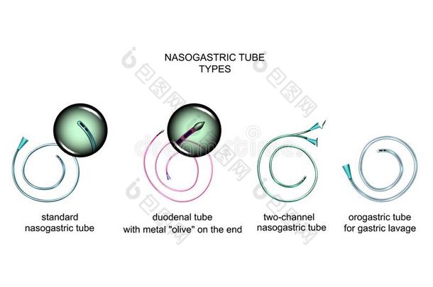 类型关于鼻胃管管