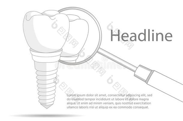 牙齿的诊所.牙齿的移植物.牙齿的设备.向一白色的b一ck