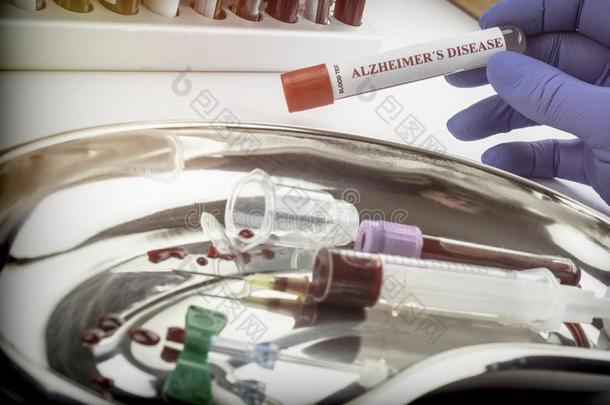 科学家保存血样品向调查治疗法反对老年痴呆症