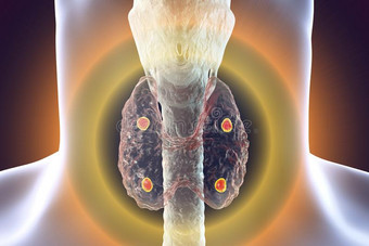 副甲状腺的腺解剖图片