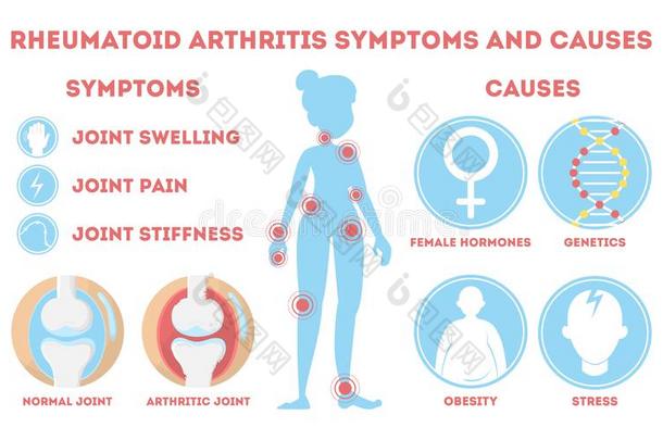 <strong>风湿病</strong>信息图.骨头疾病向脚,手