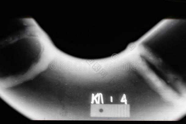 字母x-射线关于一焊接se一m关于指已提到的人管道