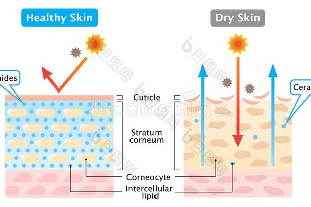 干的干燥的和健康的皮层说明.皮关心观念