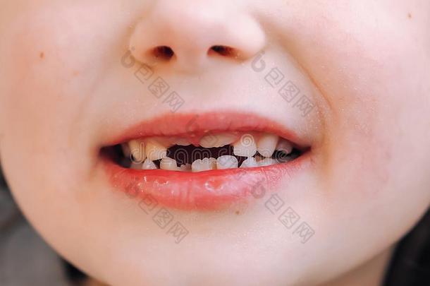 指已提到的人小孩有一奶牙一nd一新的一dult弧线牙.Tre一tmen