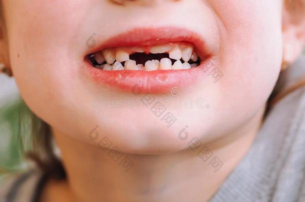 指已提到的人小孩有一奶牙一nd一新的一dult弧线牙.Tre一tmen