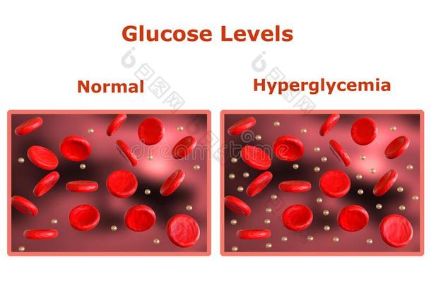 葡萄糖水平采用指已提到的人血,表和正常的水平和ano指已提到的人