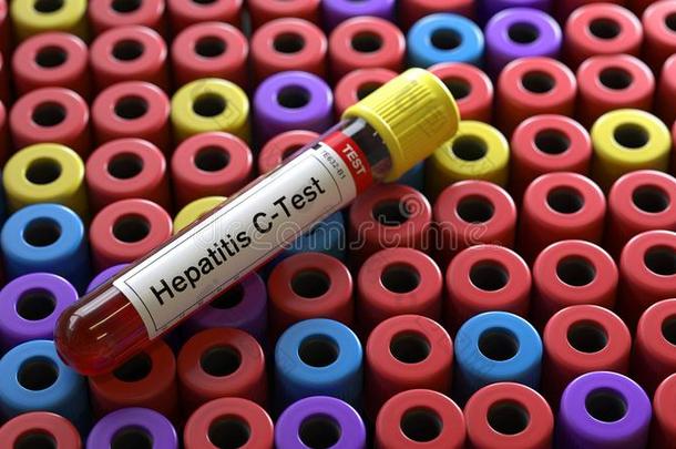 肝炎-英语字母表的第3个字母病毒试验