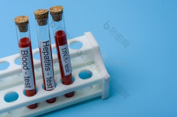 血试验<strong>肝炎</strong>试验和didnotattend没有参加试验采用体外